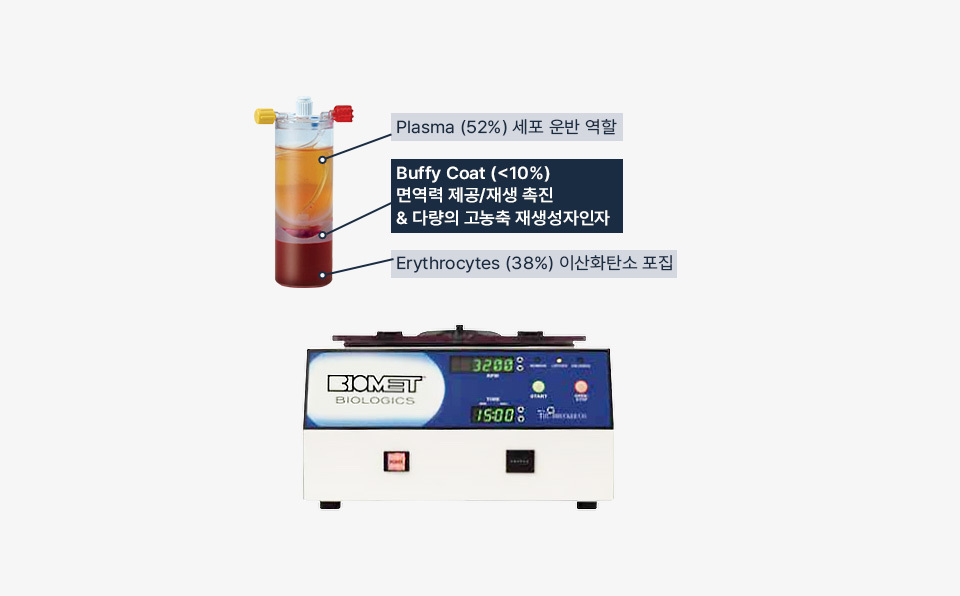 줄기세포 나나셀 회복 능력 강화
