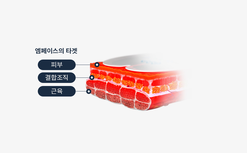 콜라겐 리모델링 주름 개선 + 타이트닝 효과