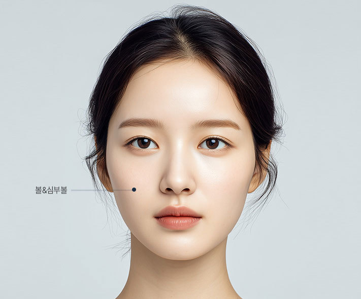 인모드 리프팅 정면