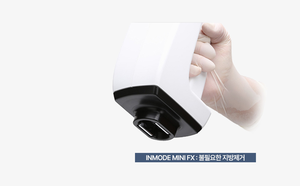 HVP (High Voltage Pulse)기술로 지방 세포 사멸