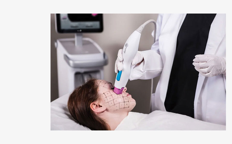 미국 FDA 승인 글로벌 스탠다드 리프팅 장비