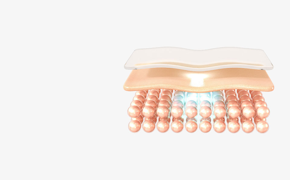 빠른 시술과 낮아진 통증부담