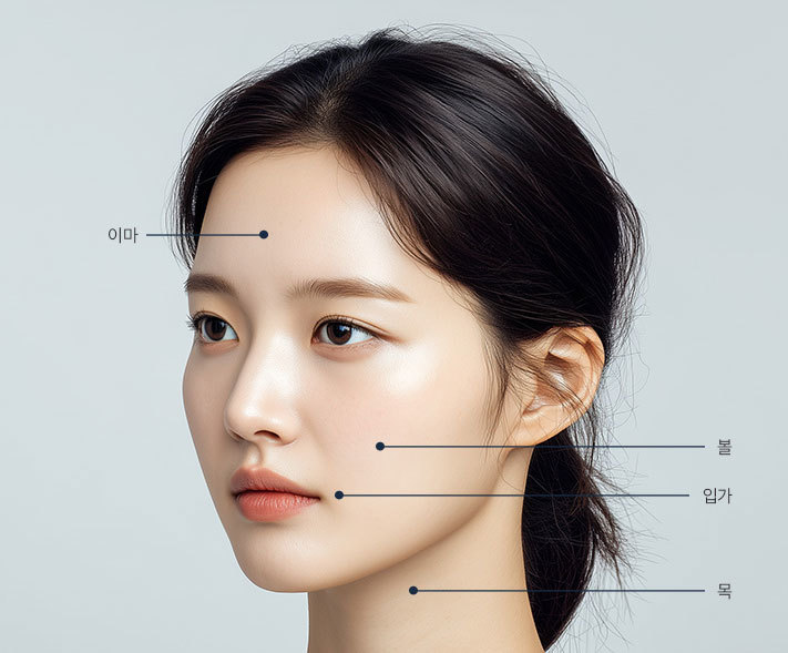 프락셀 맞춤 리프팅 측면