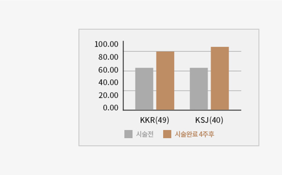 리쥬란힐러 모공 축소 & 피부결 개선