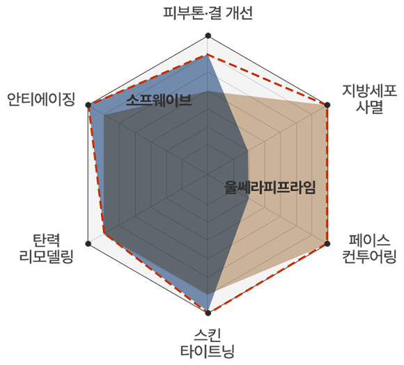 소프쎄라 차트